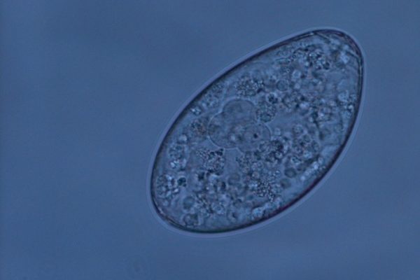 rumen|fluke|egg