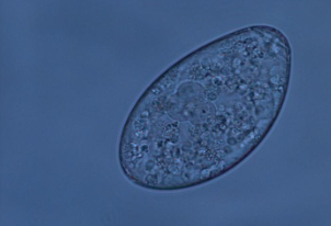 The first commercially available metacerariae of Calicophoron daubneyi